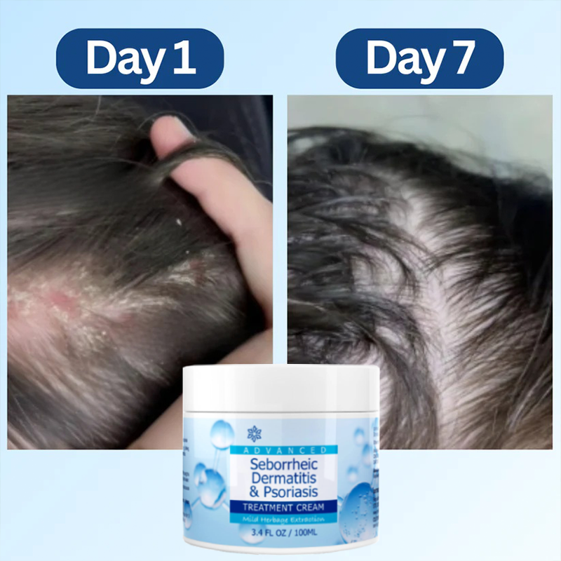 Scalp Relief Balm