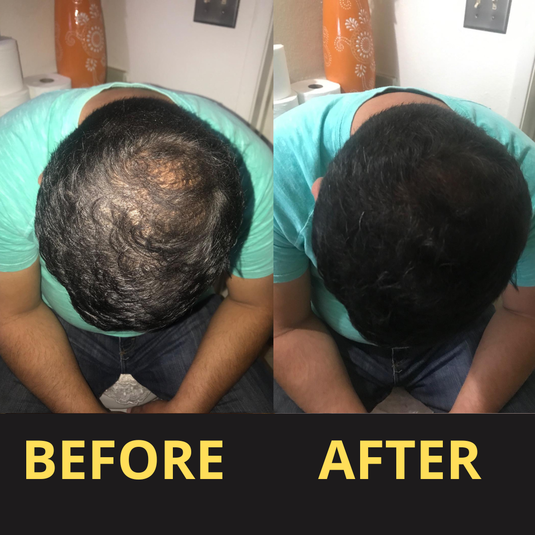 ViralLush Hair Concealer BLACK