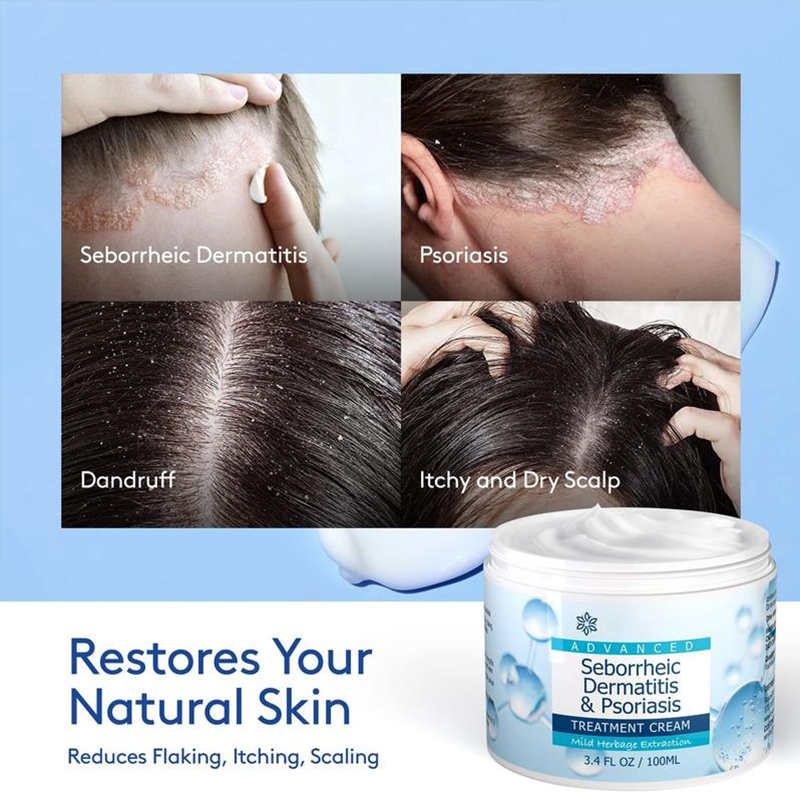 Scalp Relief Balm