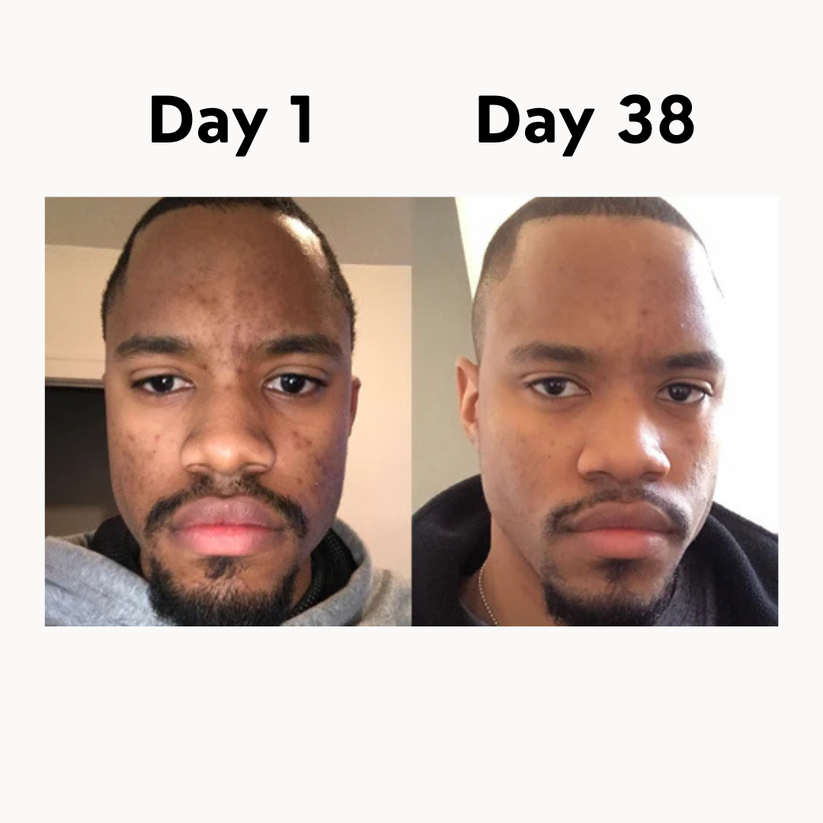 Organic Grass-Fed Beef Tallow Balm With Raw Honey