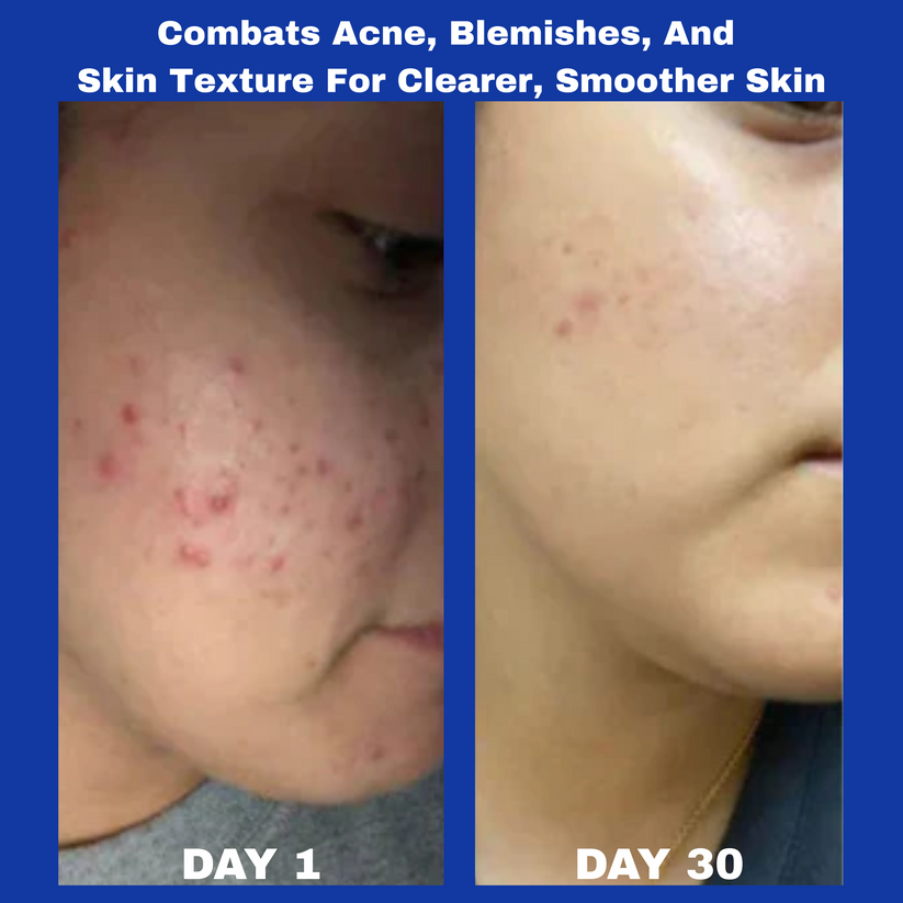 Top Sellers Duo: A313 Vitamin A Pommade + Hyaluronic Acid Anti-Wrinkle Cream