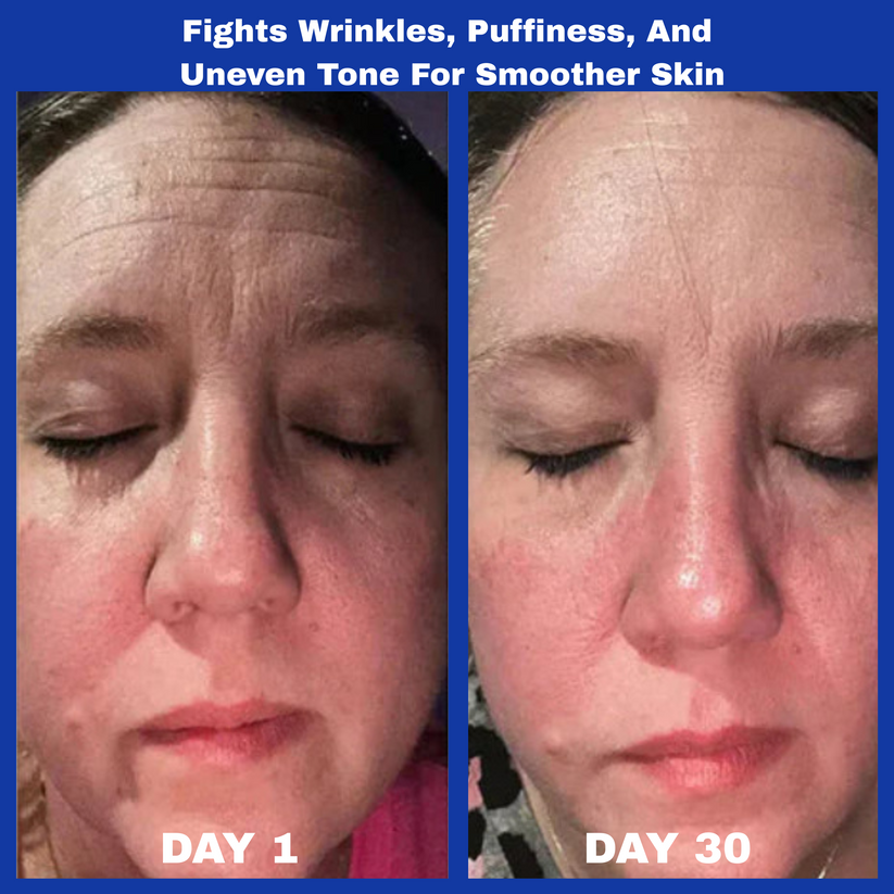 Top Sellers Duo: A313 Vitamin A Pommade + Hyaluronic Acid Anti-Wrinkle Cream