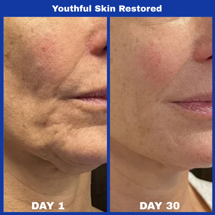 Top Sellers Duo: A313 Vitamin A Pommade + Hyaluronic Acid Anti-Wrinkle Cream