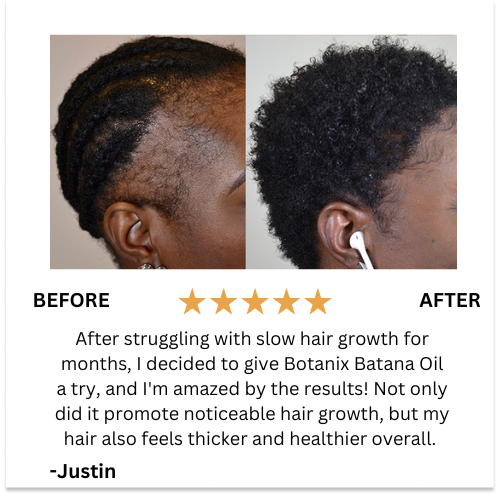 Batana Natural Hair Growth Oil 2.0