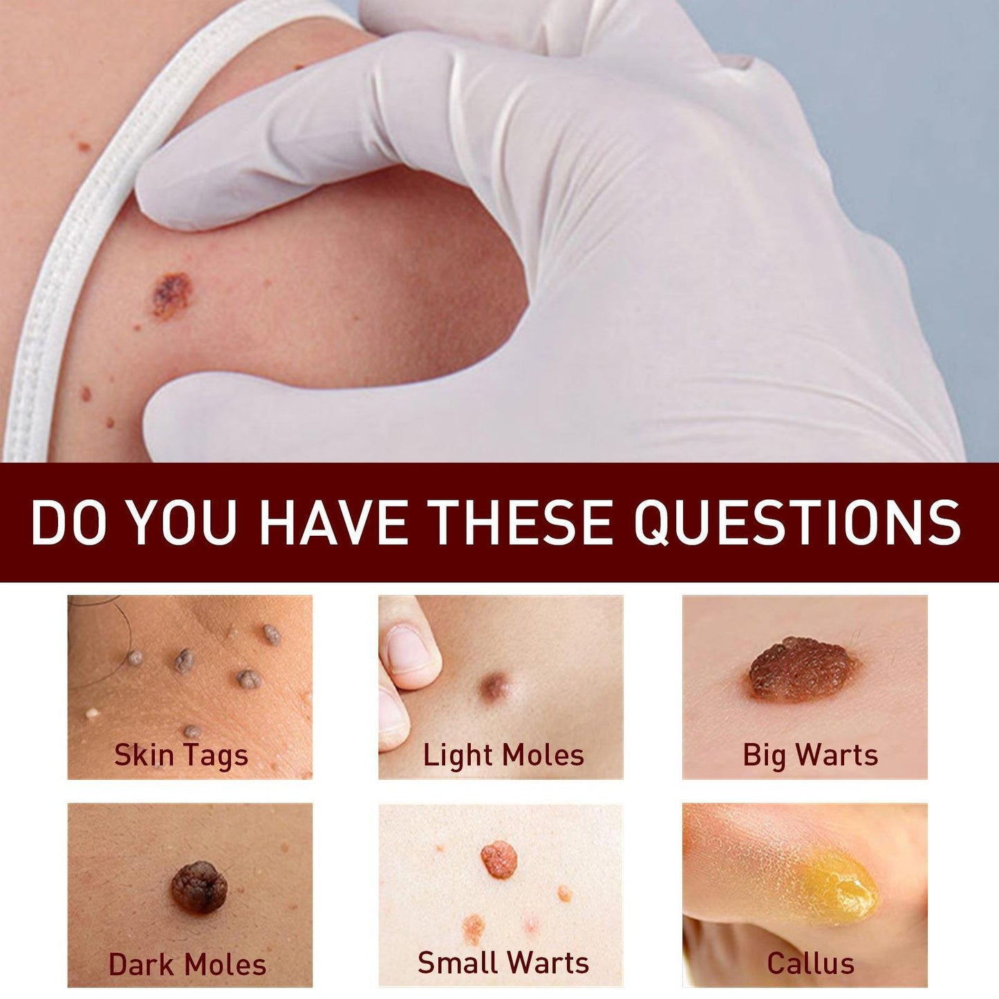 Tags & Moles Remover