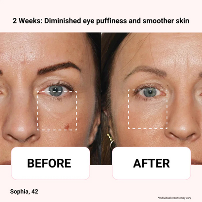 Vegan Collagen Eye Serum | 100% Authentic Korean Eye Serum