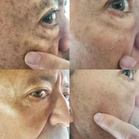 Fast Dark Spot Remover-Melanin Correcting Facial Serum