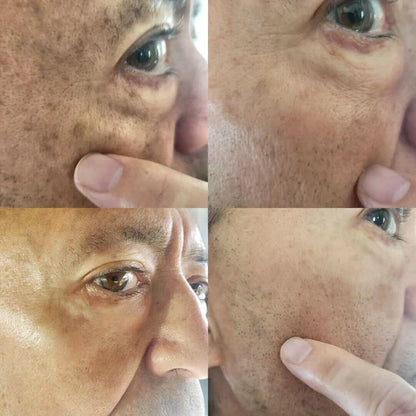 Fast Dark Spot Remover-Melanin Correcting Facial Serum