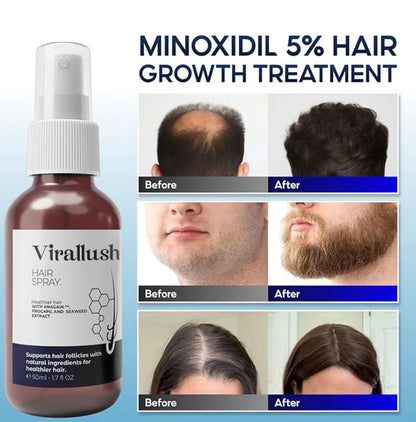 ViralLush Hair Growth Spray