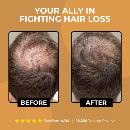 ViralLush Root Activator Shampoo