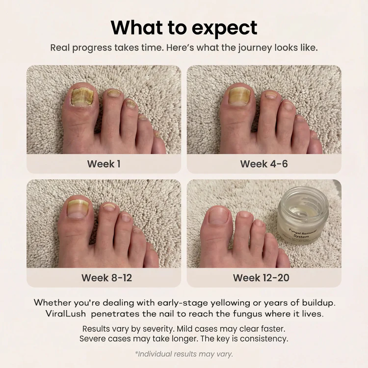 Fungal Removal System