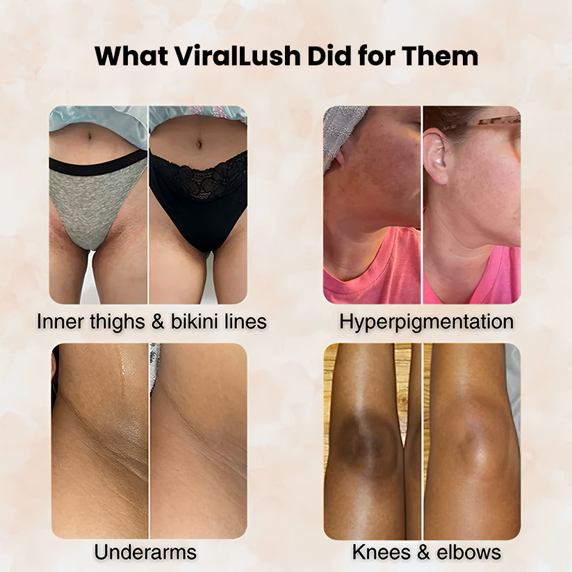 Turmeric & Kojic Acid - Skin Brightening Soap