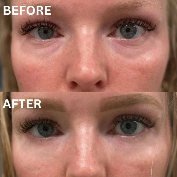 ViralLush™  Eye Patch