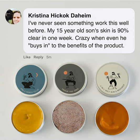 Kill Acne & Redness Ritual