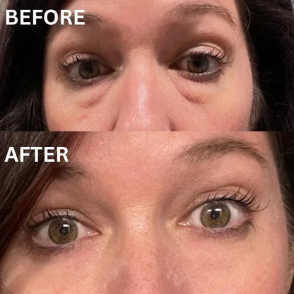 ViralLush™  Eye Patch