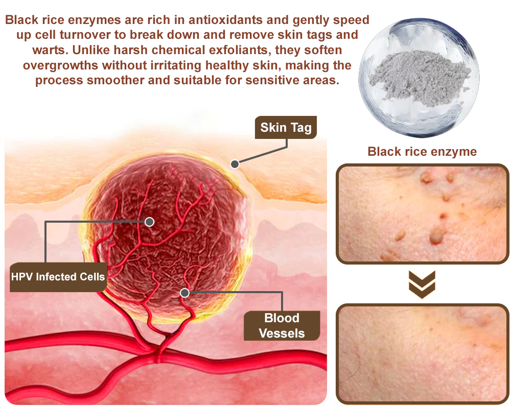 Rice Bran Extract Cream👩‍⚕️ FDA-Certified