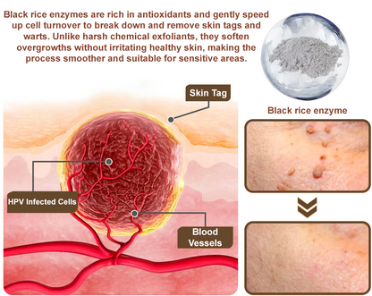 Rice Bran Extract Cream👩‍⚕️ FDA-Certified