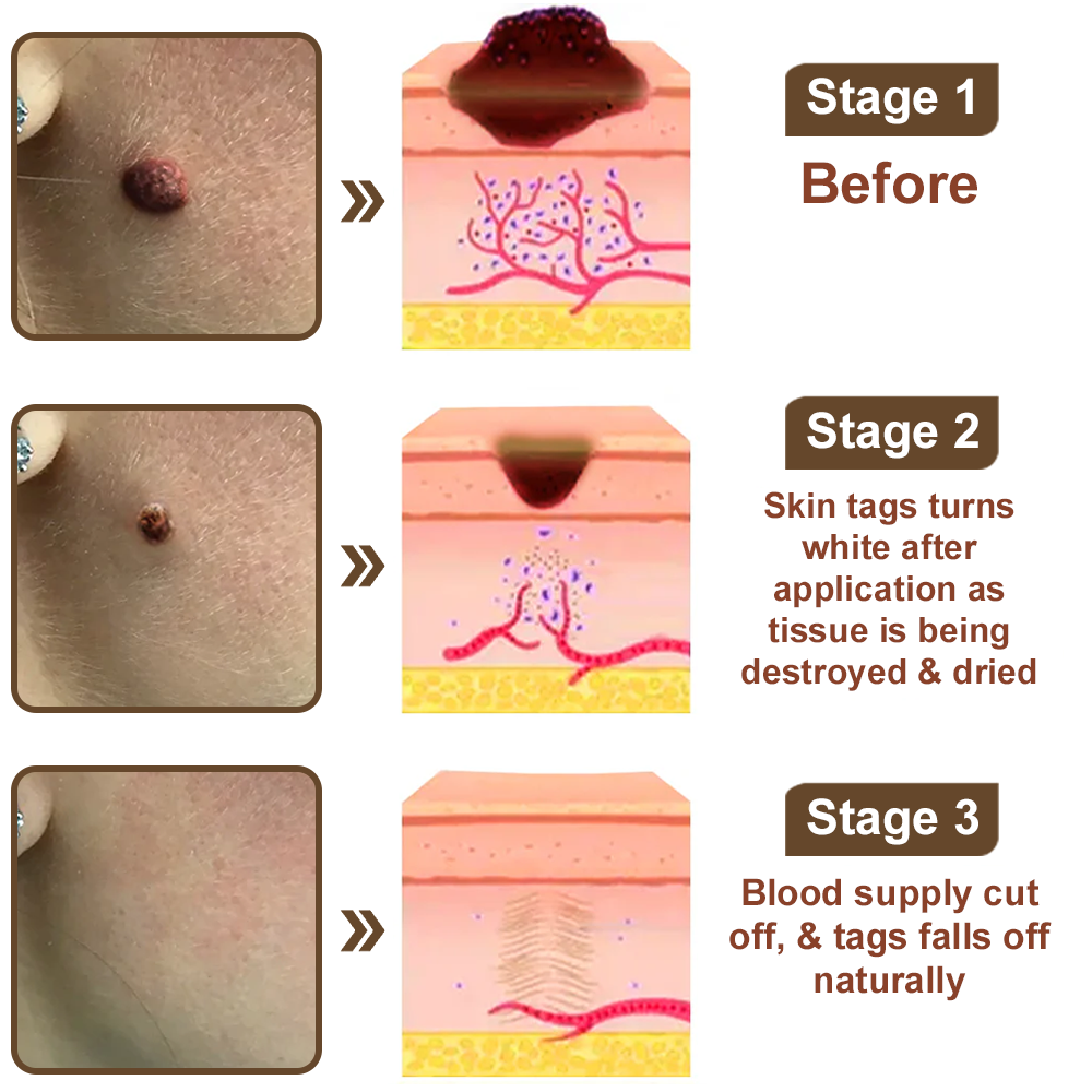 Rice Bran Extract Cream👩‍⚕️ FDA-Certified