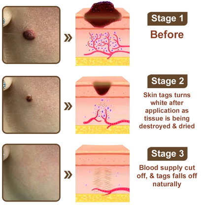 Rice Bran Extract Cream👩‍⚕️ FDA-Certified