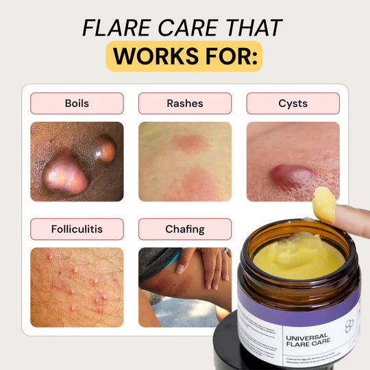Universal Flare Care