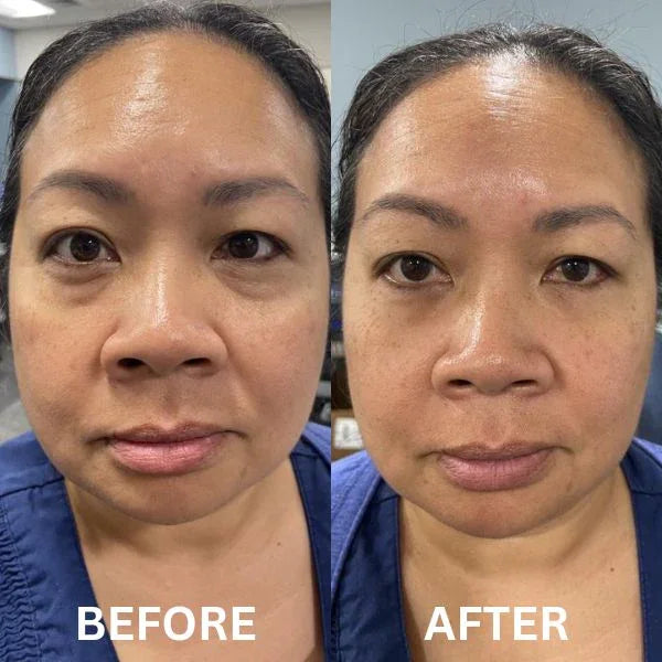 ViralLush™  Eye Patch