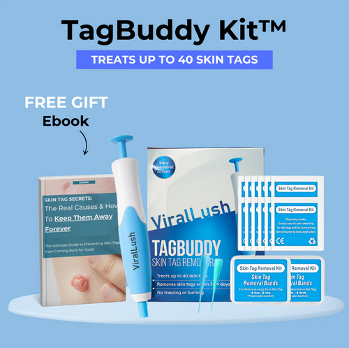 TagBuddy Kit - No More Skin Tags