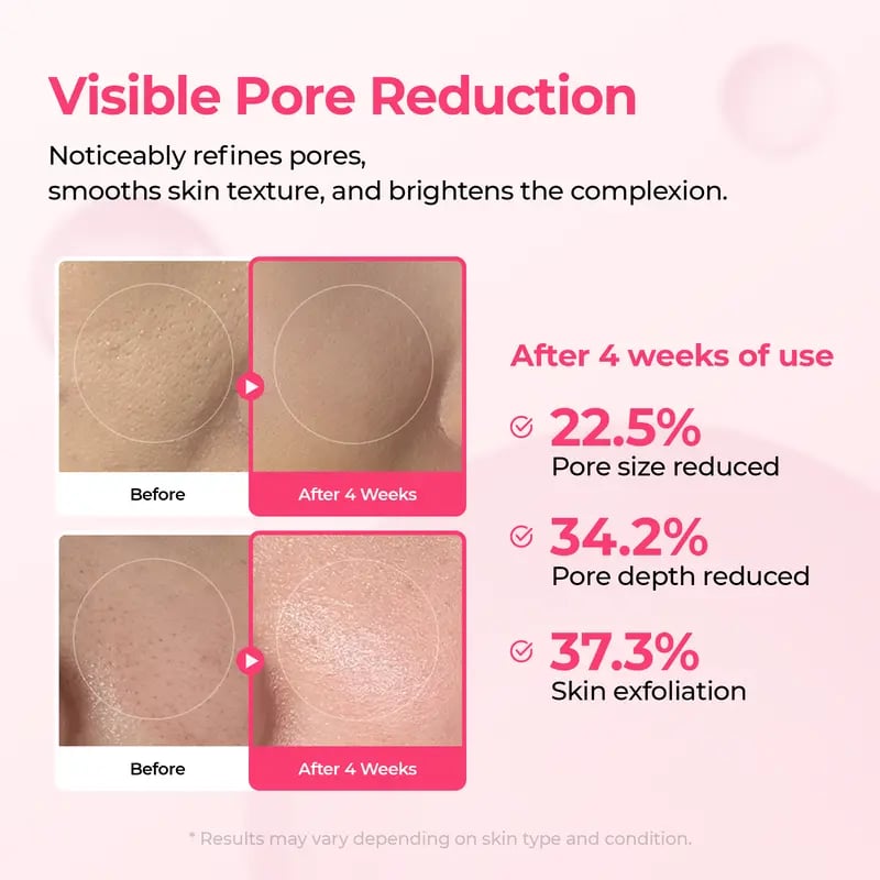 🔥Pore & Spot Care Duo