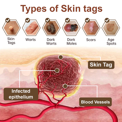 Rice Bran Extract Cream👩‍⚕️ FDA-Certified