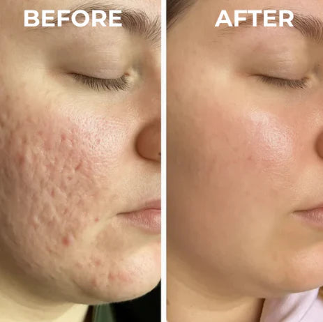 Dual Action Real Deep Collagen Sheets