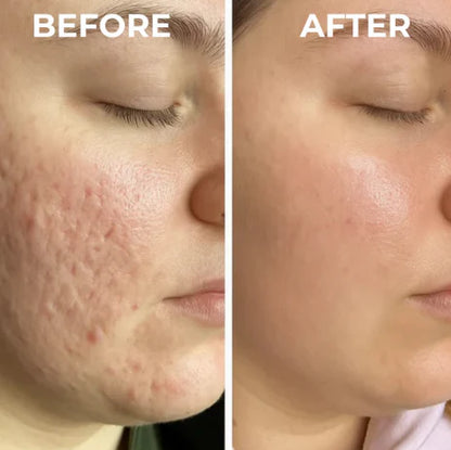 Dual Action Real Deep Collagen Sheets