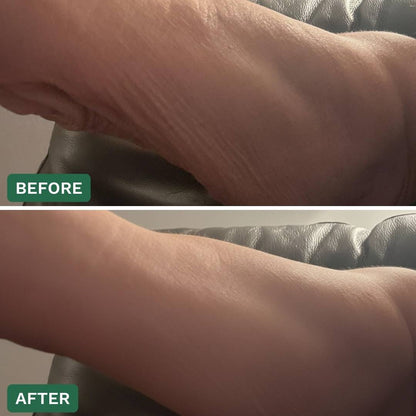 Crepey Skin Repair Cream