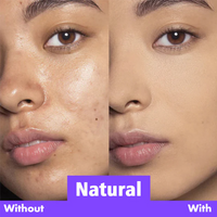 Natural