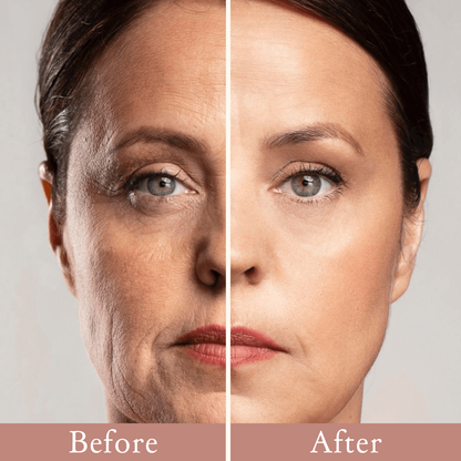 Eye Roller for Puffiness | Removes 97% of under-eye bags in 60 seconds