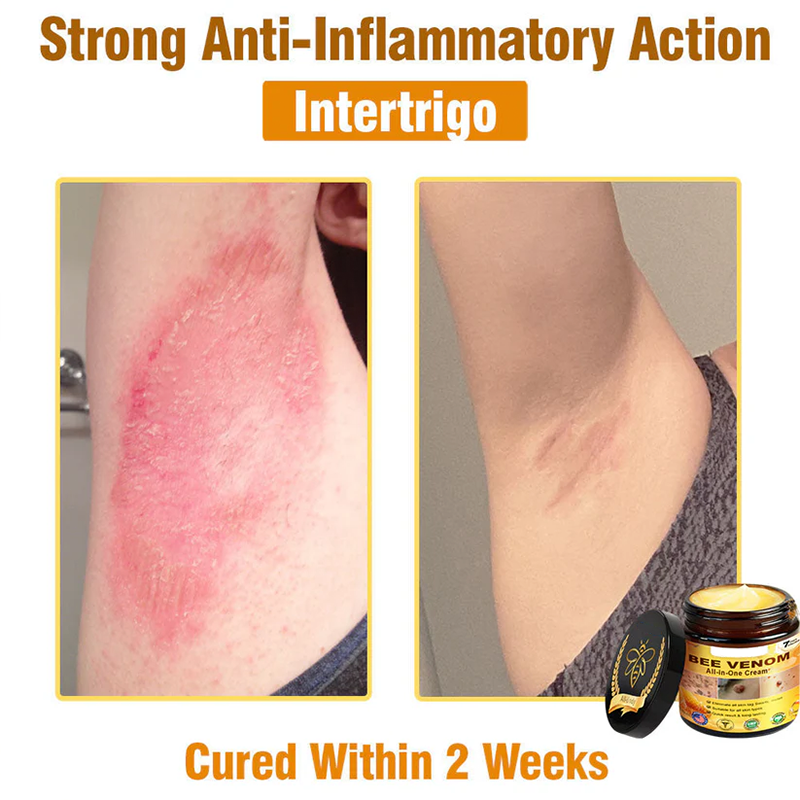 Bee Venom All-in-One Cream US Dermatologist Approved🍃