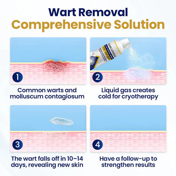 ChillErase Bump Renewal Spray