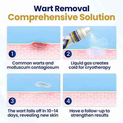 ChillErase Bump Renewal Spray