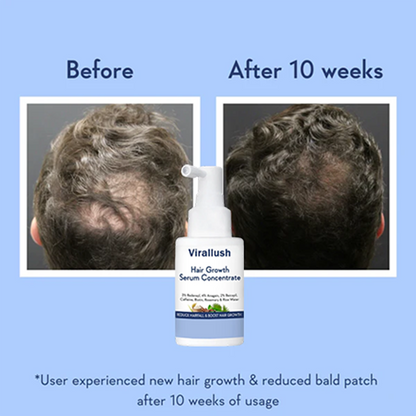 Hair Growth Serum Concentrate
