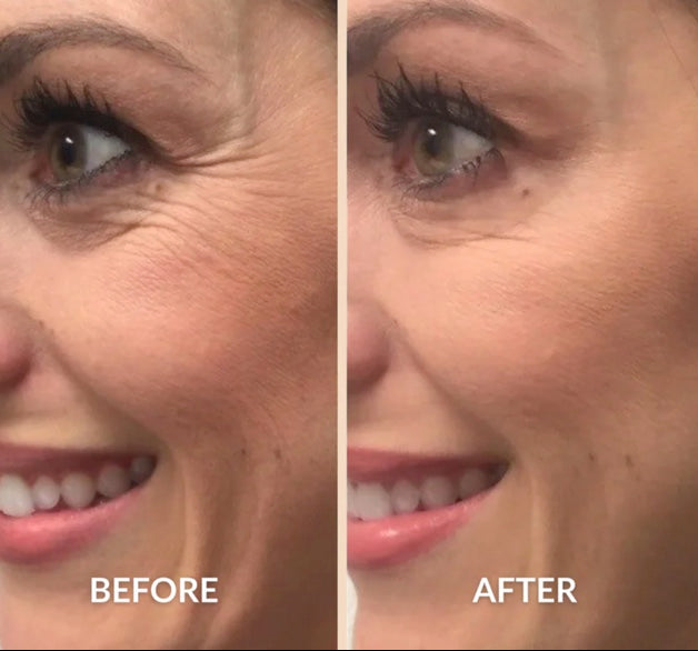 Silicone Scar Stick
