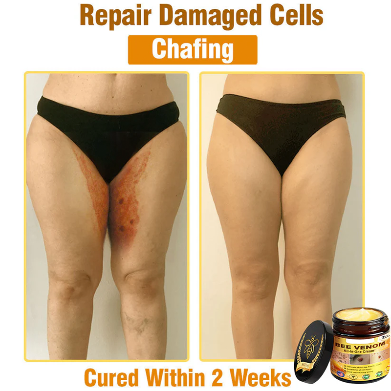 Bee Venom All-in-One Cream US Dermatologist Approved🍃
