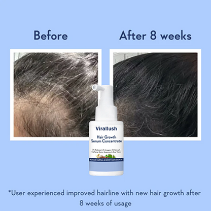 Hair Growth Serum Concentrate