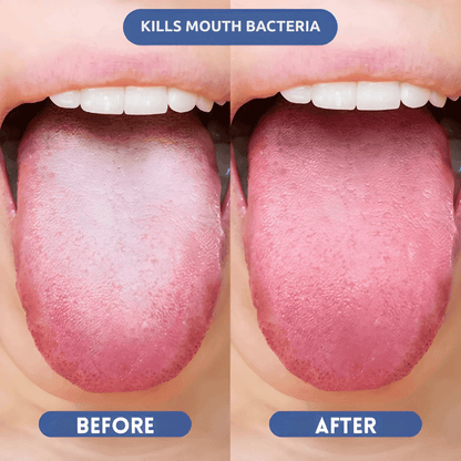 Probiotic Fresh Breath Spray