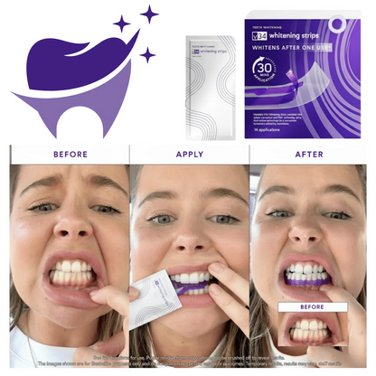 SmileV34™Whitening Strips: ‘’The Fast Track to a Stunning Smile!‘’