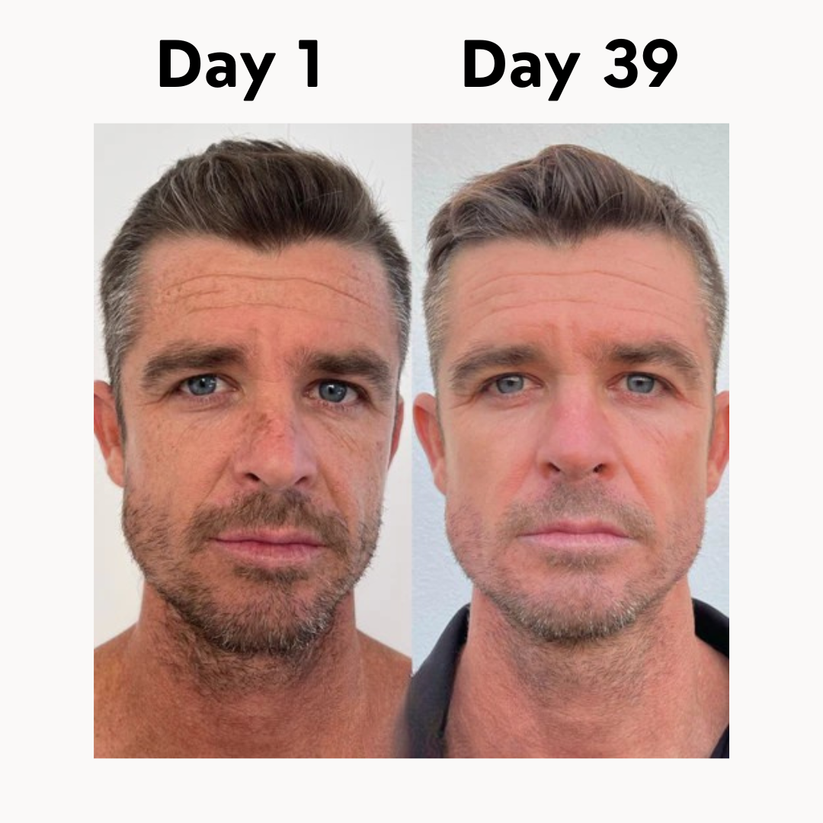 Organic Grass-Fed Beef Tallow Balm With Raw Honey