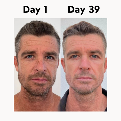 Organic Grass-Fed Beef Tallow Balm With Raw Honey