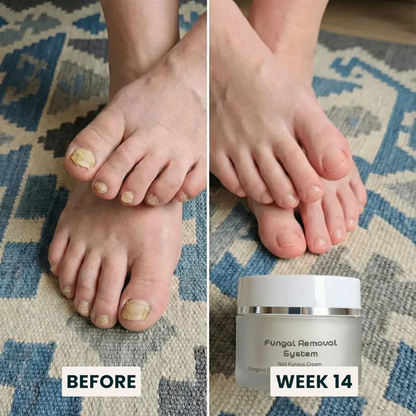 Fungal Removal System