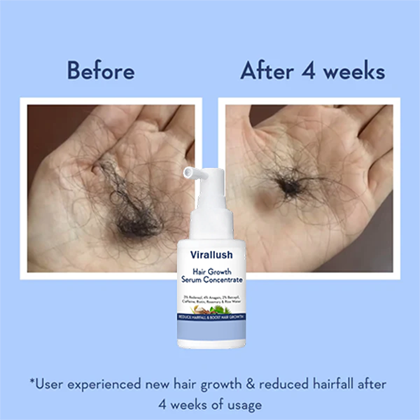 Hair Growth Serum Concentrate