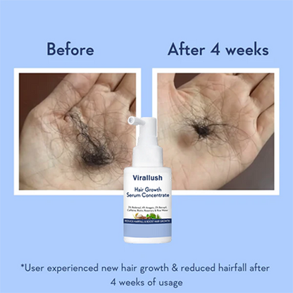 Hair Growth Serum Concentrate