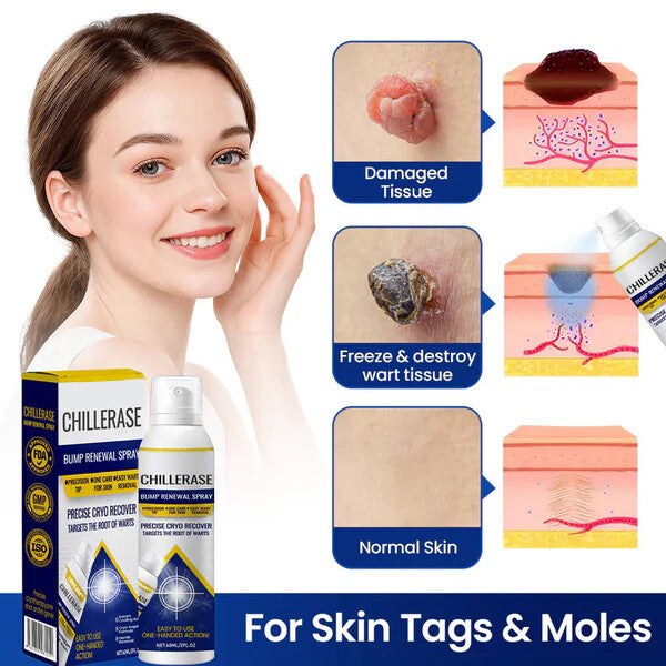 ChillErase Bump Renewal Spray