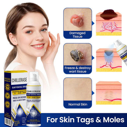 ChillErase Bump Renewal Spray