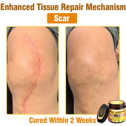 Bee Venom All-in-One Cream US Dermatologist Approved🍃